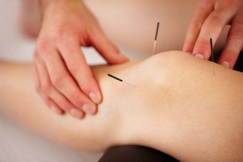 Acupuncture for knee physical therapy from Juliet Schmalz M.D.